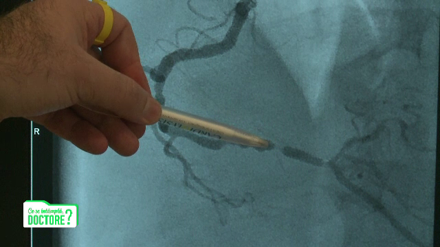 Obezitatea este o boală care produce modificări în tot corpul. Ce se întâmplă când apare și Covid-19