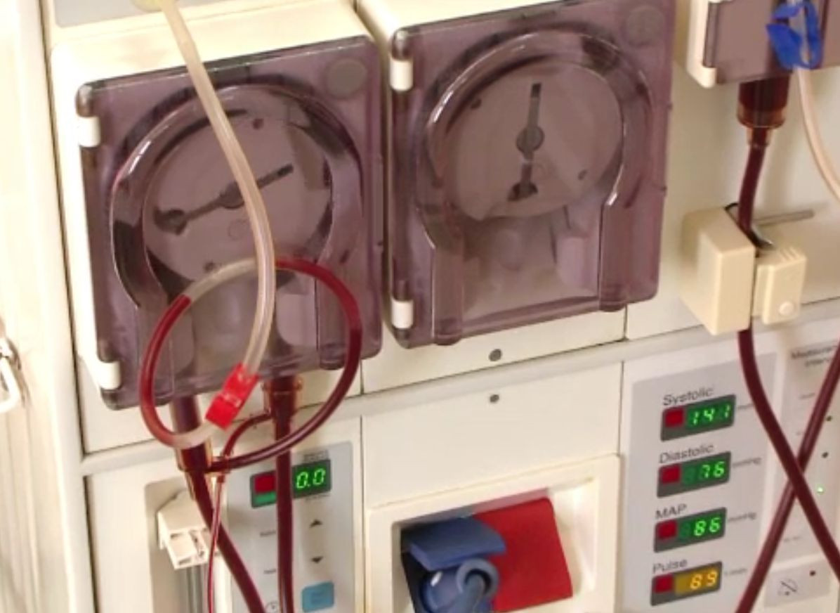 Un bărbat în moarte cerebrală le-a dat o șansă la viață altor doi pacienți. Rinichii au fost transplantați la Iași