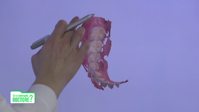 Pierderea timpurie a dinților de lapte afectează maxilarele. Cum poate fi prevenită