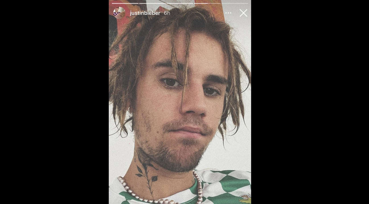 Scandal cu Bieber. Vedeta, acuzată de furt de identitate culturală, după ce și-a schimbat coafura