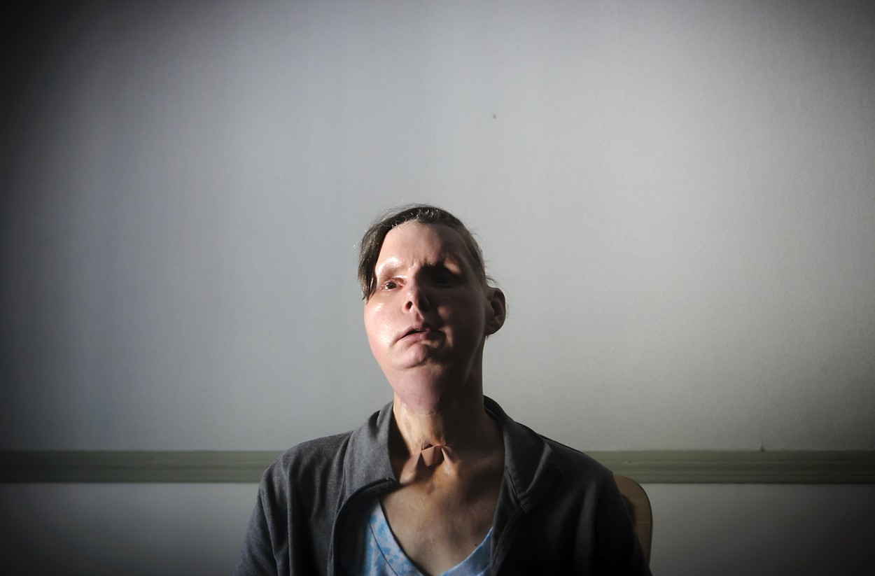 Un cimpanzeu a mutilat o femeie din SUA. Victima a pierdut jumătate din sânge și a orbit