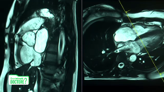 CSID. Efectele post-Covid la care sunt predispuși tinerii, chiar și după infecții ușoare