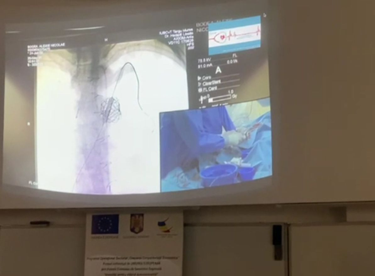 Trei copii, operați neinvaziv la Târgu Mureș, în locul unei proceduri riscante pe cord
