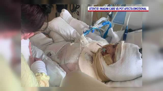 O fată a vrut să reproducă un filmuleţ pe care l-a văzut pe TikTok, dar lucrurile au luat o întorsătură îngrozitoare