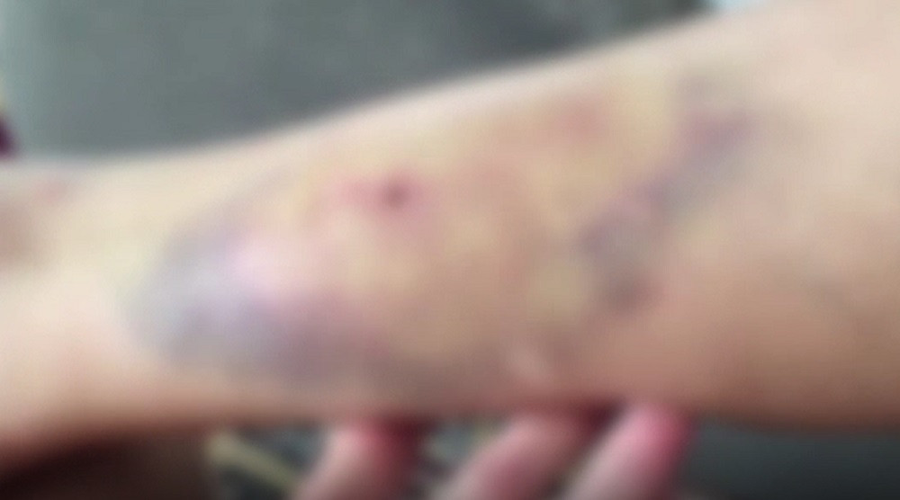 O femeie din Bistrița-Năsăud a fost snopită în bătaie de propriul soț, chiar sub ochii copiilor