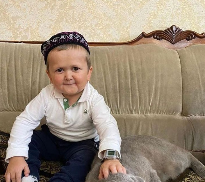 Un băiat cu o boală rară a devenit senzație pe Internet. Un medic spune de ce pare și copil, și adult în același timp