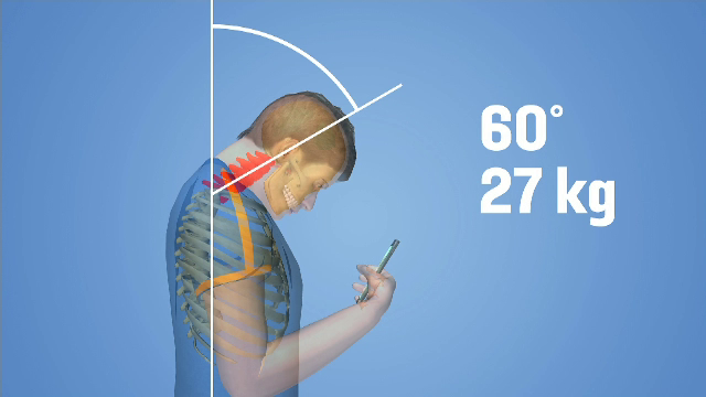 Privitul ecranelor determină hernia de disc. Cum se repară leziunile din interior, fără operație. Când e utilă kinetoterapia