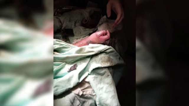 O fetiţă în vârstă de 5 ani a rămas cu mâna prinsă în tubul de absorţie al unei piscine, la un hotel din Mamaia