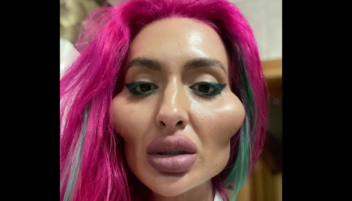 Fotomodel pe Instagram, a cheltuit 1800 de euro ca să arate așa: ”Nu o să mai ascult de medici”