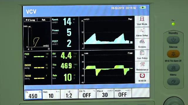 O fetiță din Cluj, moartă într-un accident, a salvat viețile a 4 copii. ”Băiețelul meu avea șanse 1 la mie”