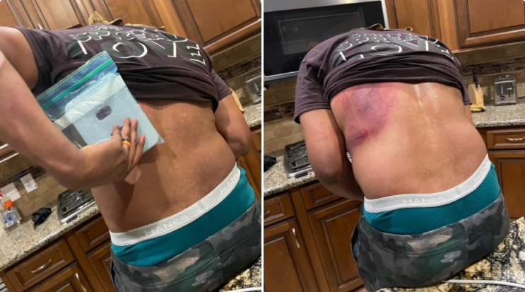 O nouă provocare virală pe TikTok poate fi extrem de periculoasă. Medic: „Riscați să faceți hemoragie”