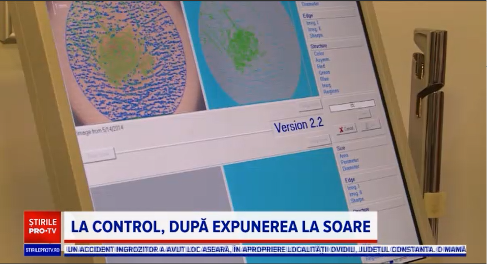De ce nu e bine să ne controlăm singuri alunițele mai des de o dată pe săptămână. Când trebuie să mergem la doctor