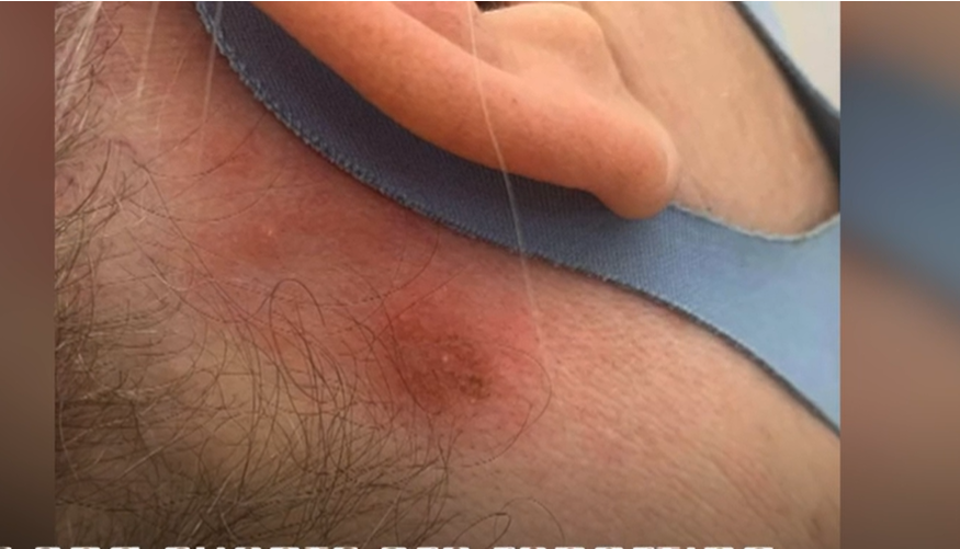 VIDEO. Ce se întâmplă dacă îți vopsești părul după ce ai avut Covid-19