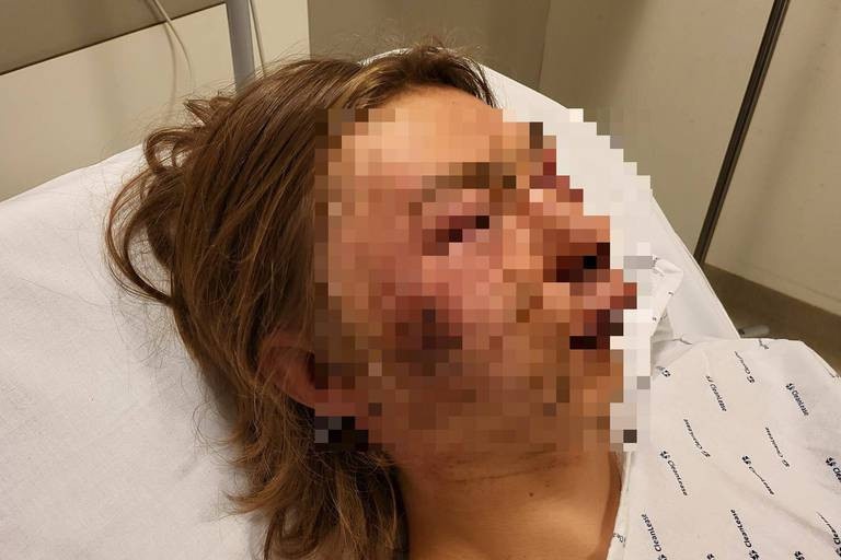 Adolescent desfigurat pe stradă, în Belgia, pentru că se întâlnea cu o fată cecenă. Reacția tatălui său