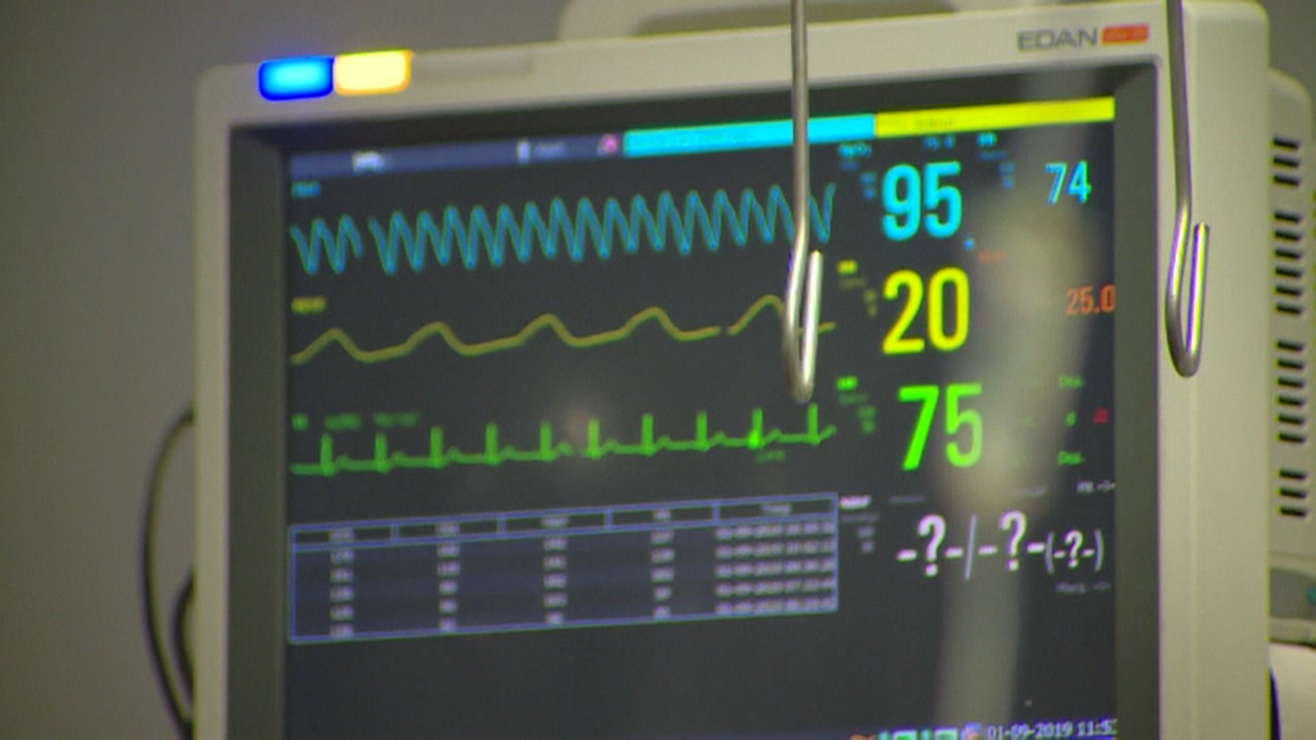 Un bărbat din Sibiu este în comă profundă, după ce a fost bătut de hoți în propria casă