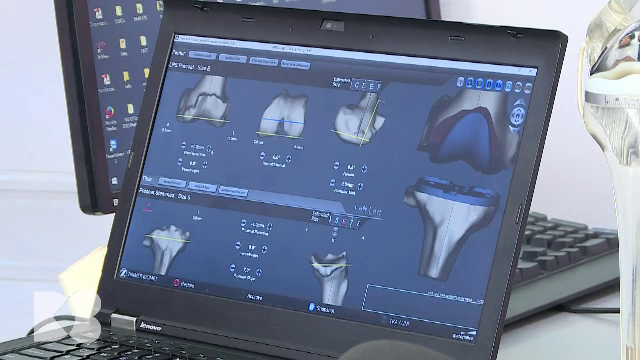 Durerile articulare, un motiv de îngrijorare. Ce alte boli, în afară de artroză, pot semnala