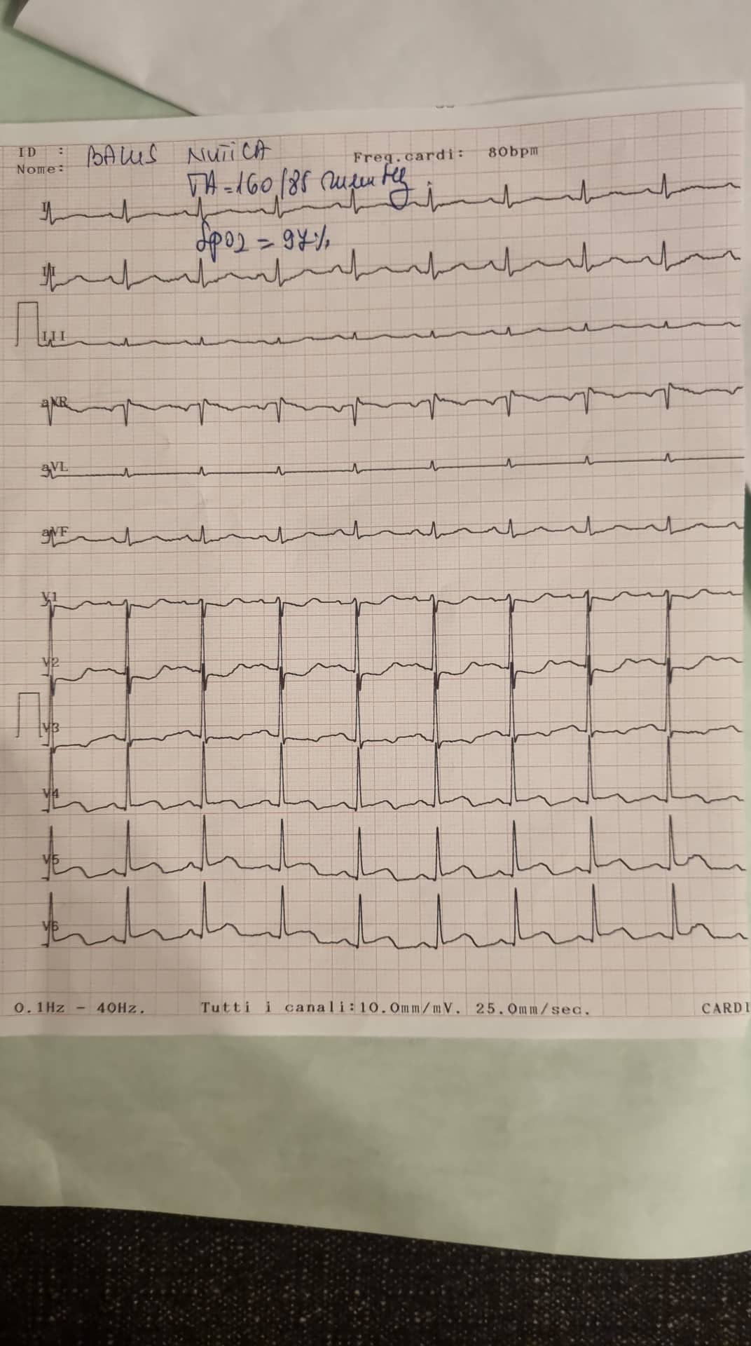 Acuzații de malpraxis, după moartea unei femei din Bacău: “Mama s-a dus la spital cu infarct și a plecat cu faringită”