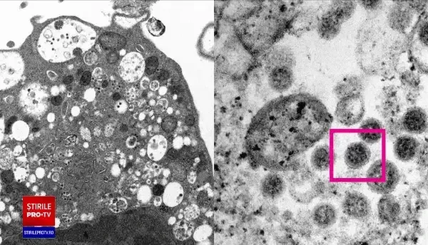 “România merge în direcția opusă UE”. Am putea ajunge la peste 30.000 de cazuri noi pe zi