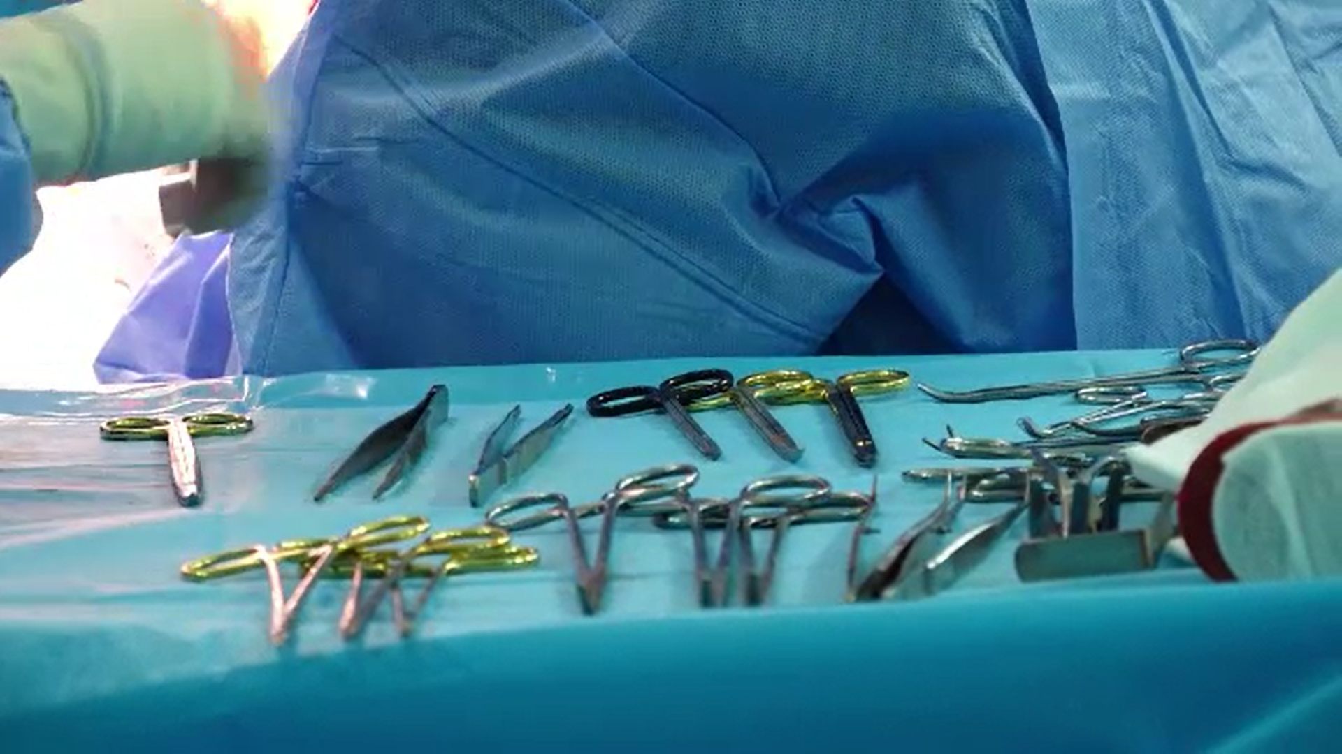 Un bărbat din Suceava, care avea un rinichi de peste 6 kilograme, a primit o nouă șansă la viață