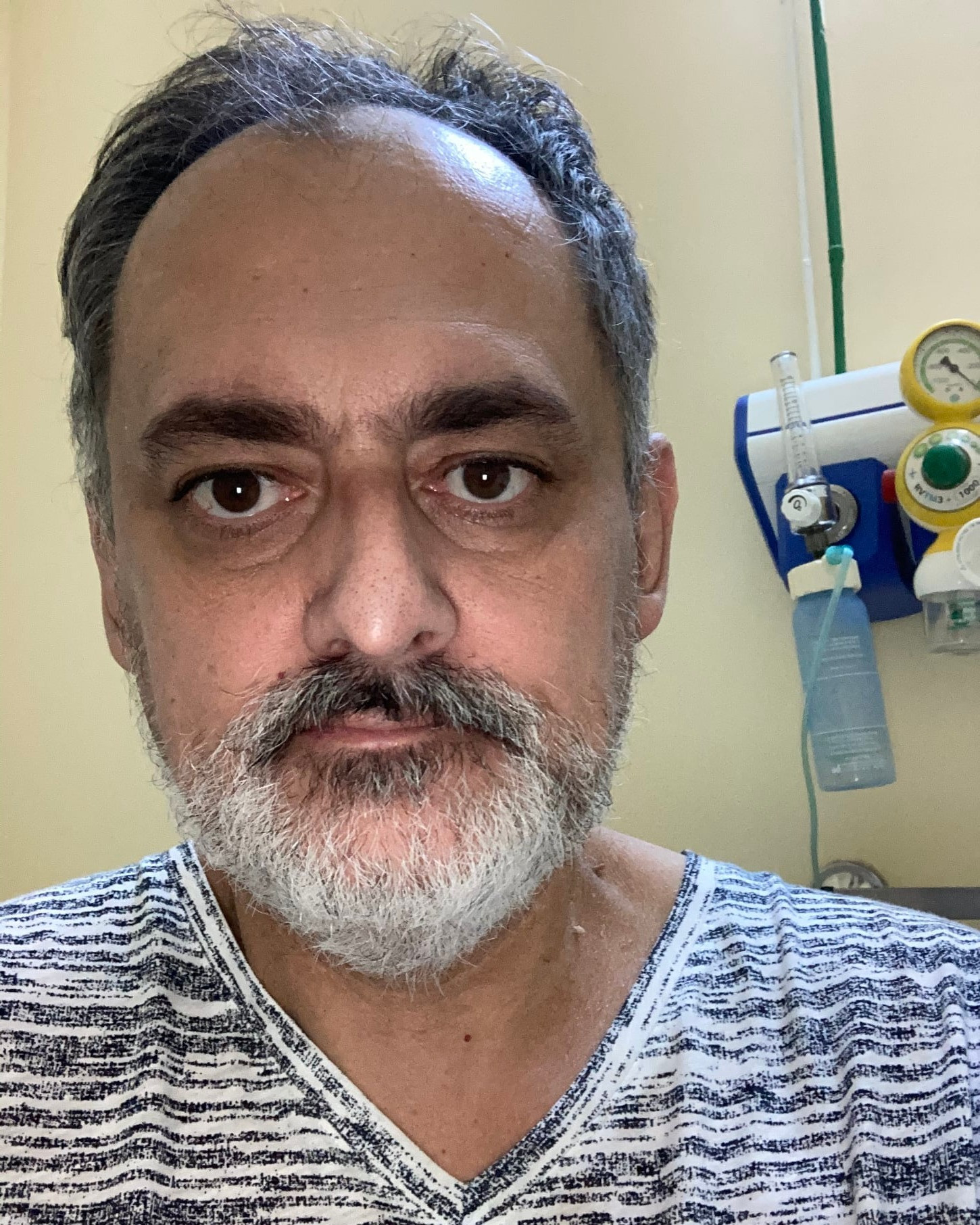 Cum se simte un rom&acirc;n la un an după ce a avut Covid-19. Boala i-a provocat afecțiuni care-l vor marca tot restul vieții