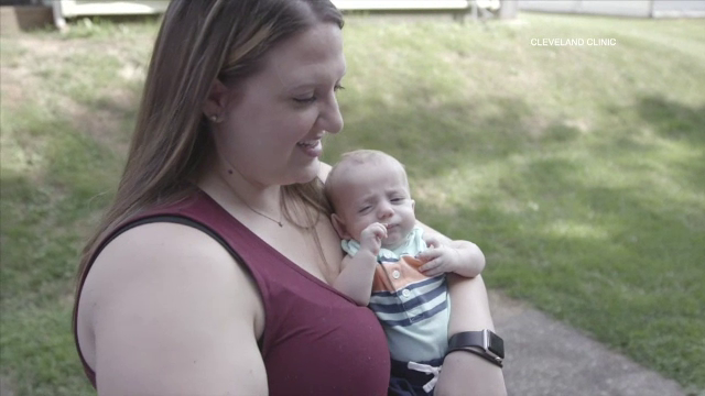 Un făt nenăscut a fost operat cu succes, după ce i s-a depistat o tumoră pe inimă