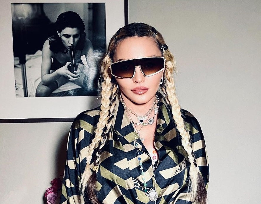 FOTO Madonna și-a desfăcut picioarele în fața camerei pentru a arăta o vânătaie. „M-a bătut viața”