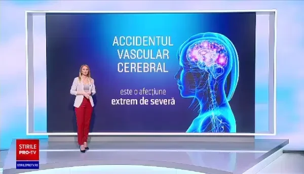 Accidentul Vascular Cerebral (AVC) - ce este și cum îl recunoaștem. Testul FAST poate salva vieți