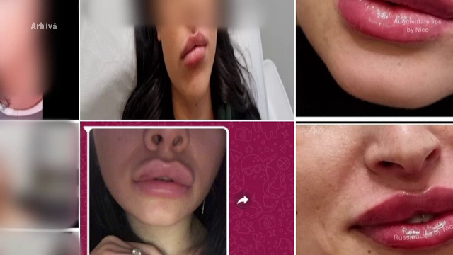 Încă un medic estetician fals. Profesa de mai mult timp și avea cabinete în Cluj-Napoca și în Londra