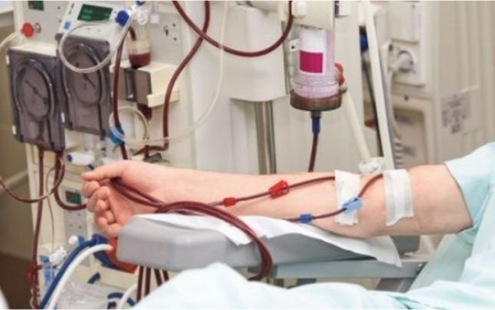 Riscul glicemiei mari: 40% dintre pacienții care ajung la dializă au și diabet