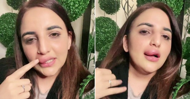 O influenceriţă, vedetă pe TikTok, susține că a rămas cu o buză umflată după ce a rămas fără bani