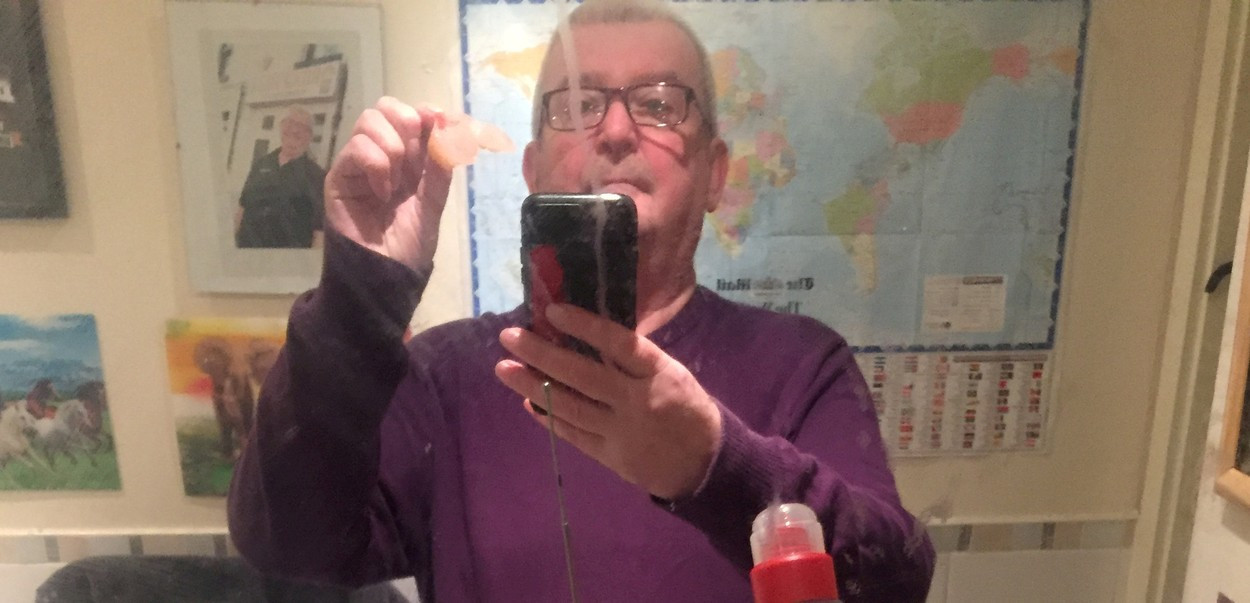 Un britanic a primit prin poștă proteza dentară pierdută în urmă cu 11 ani în Spania