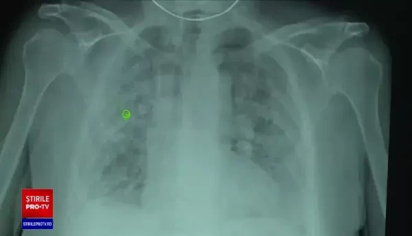 Avertismentul îngrijorător al medicilor: Mergeți la control, dacă v-ați infectat cu coronavirus și nu aveți simptome