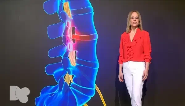 Legătura dintre fumat și hernia de disc. Cum se tratează boala și când apar durerile