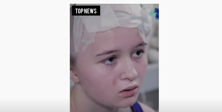 O fată din Ucraina a supraviețuit miraculos după ce o bucată de șrapnel i s-a înfipt în cap și s-a oprit în creier