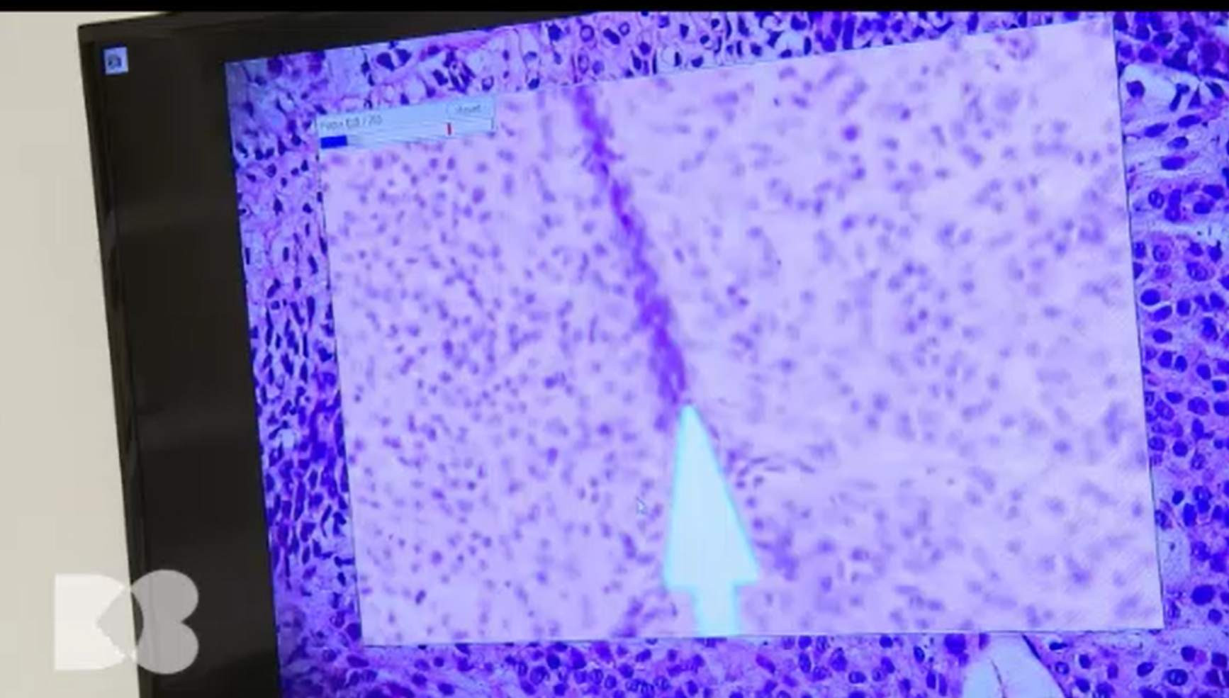 Protecția solară, indispensabilă pentru persoanele cu piele albă. Legătura nebănuită cu geamurile