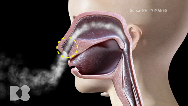 Doctor de bine | Cum se tratează deviația de sept