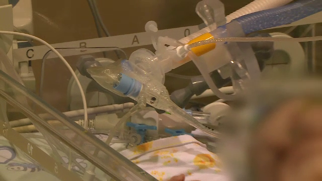 România ar avea nevoie de cinci centre în care să fie operați copiii cu probleme cardiace