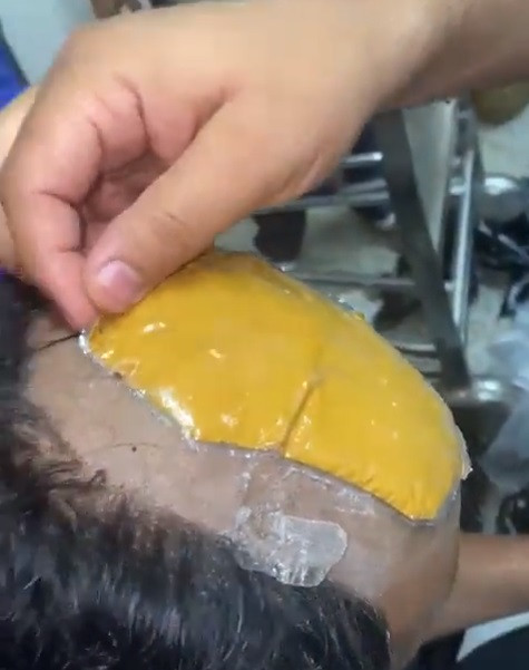 Un bărbat a încercat să treacă prin aeroport cu aur ascuns sub perucă. VIDEO