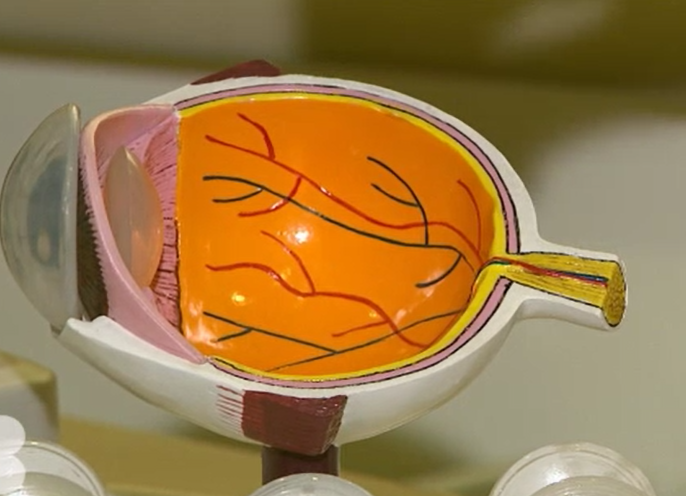 Diabetul poate să producă dezlipirea de retină. Recomandarea specialiștilor