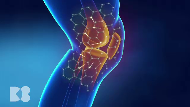 Ce este radiologia intervențională care vindecă articulațiile