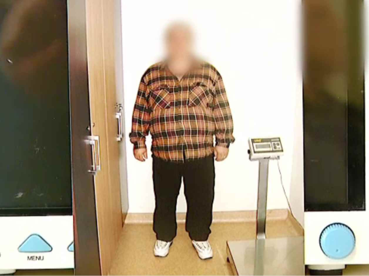 Obezitatea a devenit un fenomen îngrijorător în Europa, după pandemie. În România, 60% dintre adulți sunt supraponderali