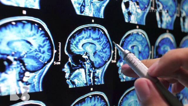 Doctor de bine | Ce se întâmplă în mintea adolescenților când vine vorba de mâncarea bogată în grăsimi