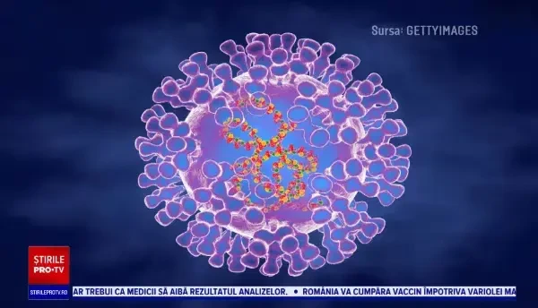 Autoritățile sanitare, alertate de postarea unui medic care a anunțat un posibil caz de variola maimuței în Rădăuți