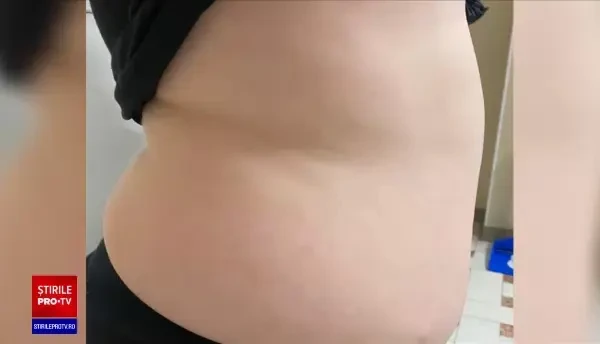 România este pe primele locuri la obezitate infantilă. Parlamentarii cer taxarea suplimentară a dulciurilor