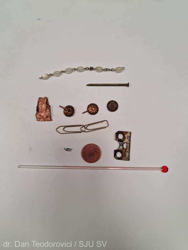 Doctorii din Suceava au scos din stomacul unui bărbat piuneze, o balama de ușă, o brățară și o parte dintr-un termometru