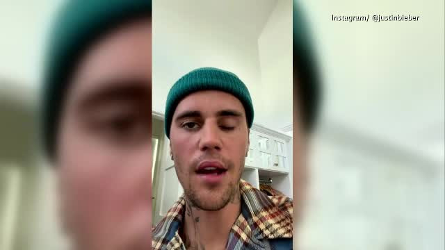Justin Bieber a dezvăluit că suferă de o paralizie facială: „Nu pot să clipesc cu un ochi”