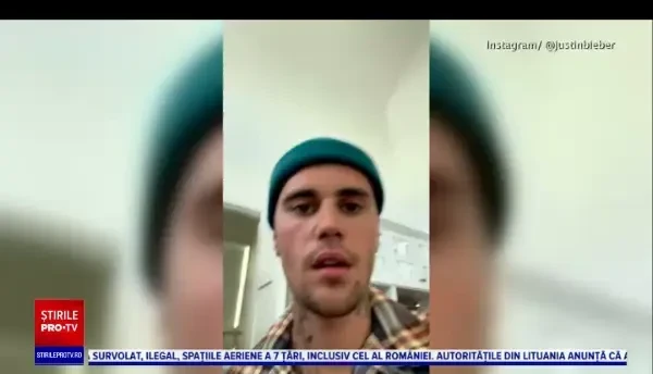 Justin Bieber a dezvăluit că suferă de o paralizie facială: „Nu pot să clipesc cu un ochi”