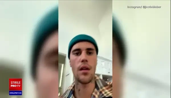 Ce este sindromul Ramsay Hunt, boala de care suferă Justin Bieber