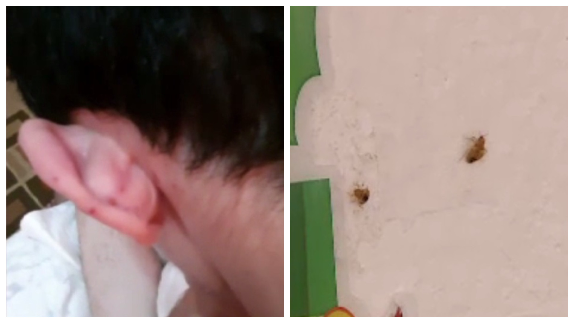 Revoltător. Centru de plasament din Drobeta-Turnu Severin, invadat de ploșnițe. Pacienții, mușcați pe tot corpul