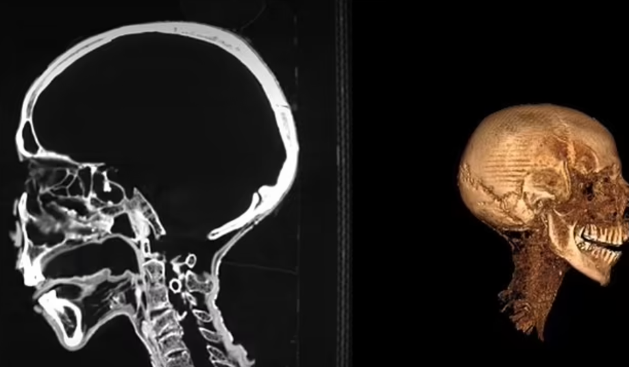 Descoperire macabră în podul casei unui medic din Marea Britanie